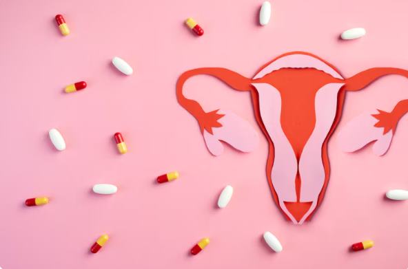 polycystic ovary